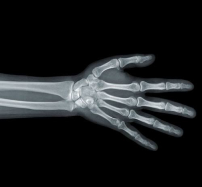 xray
